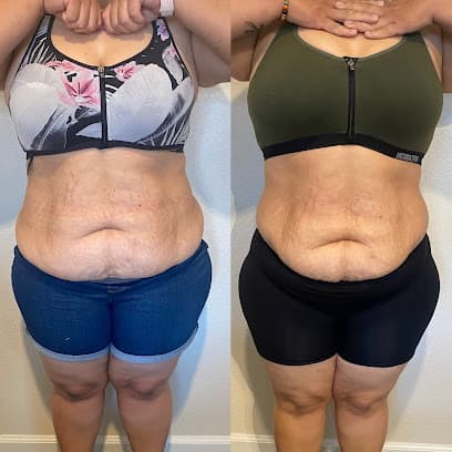 Beauty And Bella Body Contouring - Spa in Sacramento, CA